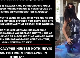 Post apocalypse hunter Hotkinkyjo self anal fisting plus prolapse in public